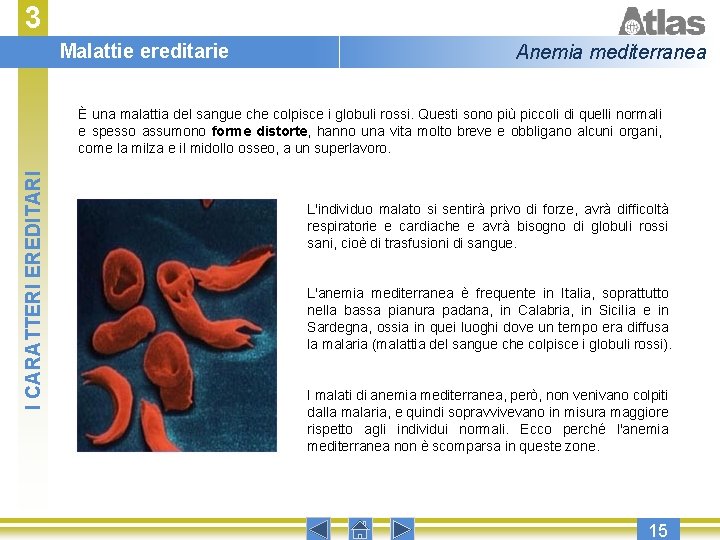 3 Malattie ereditarie Anemia mediterranea I CARATTERI EREDITARI È una malattia del sangue che