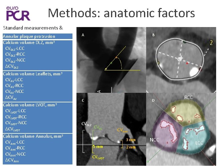 Methods: anatomic factors Standard measurements & Annular plaque protrusion Calcium volume DLZ, mm 3