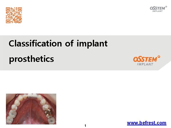 Classification of implant prosthetics 1 www. befrest. com 