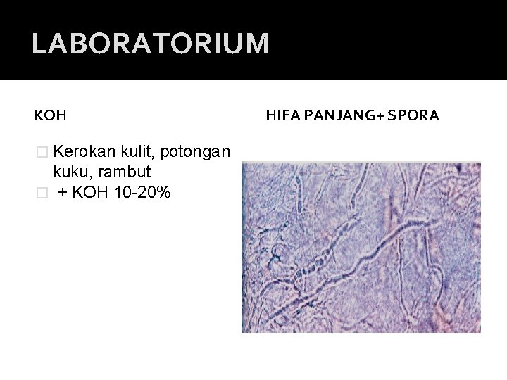 LABORATORIUM KOH � Kerokan kulit, potongan kuku, rambut � + KOH 10 -20% HIFA