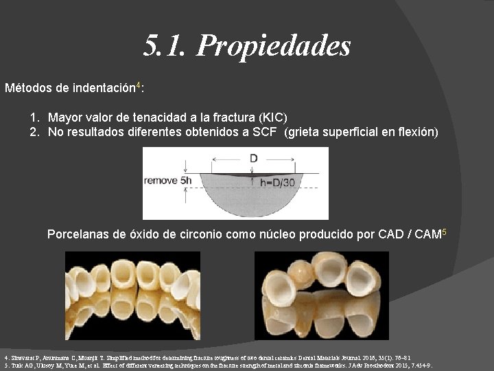 5. 1. Propiedades Métodos de indentación 4: 1. Mayor valor de tenacidad a la
