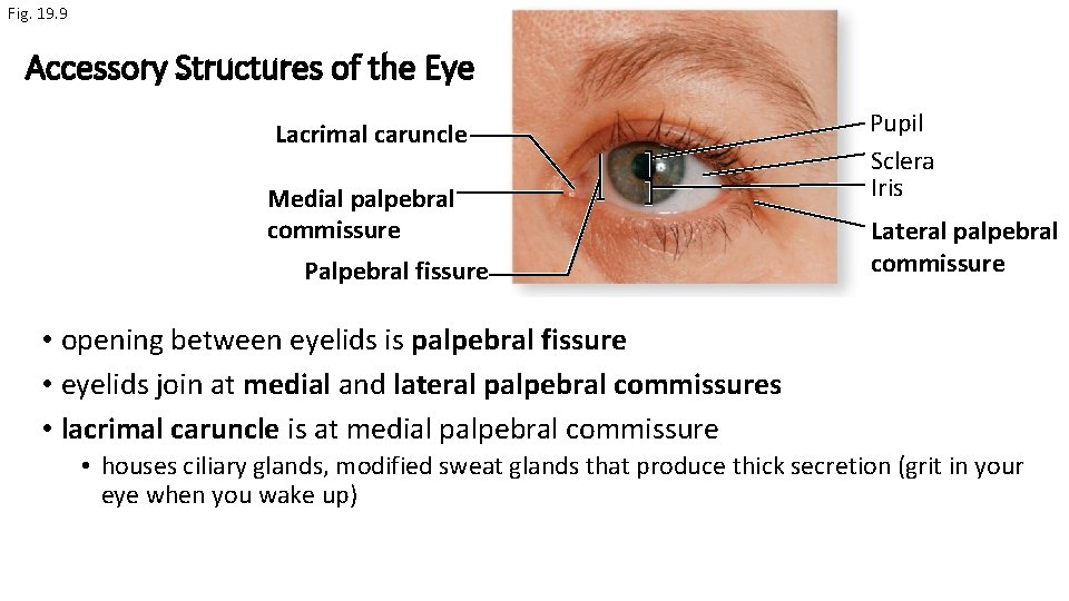 Fig. 19. 9 Accessory Structures of the Eye Lacrimal caruncle Medial palpebral commissure Palpebral