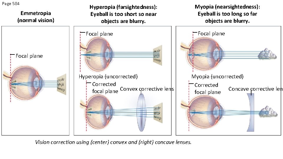 Page 584 Emmetropia (normal vision) Myopia (nearsightedness): Eyeball is too long so far objects