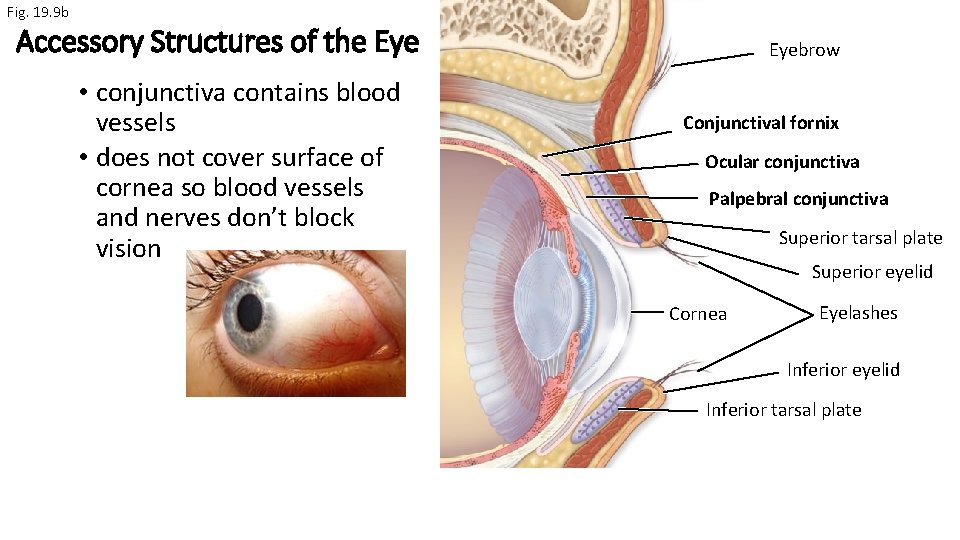 Fig. 19. 9 b Accessory Structures of the Eye • conjunctiva contains blood vessels