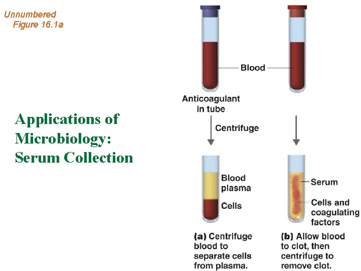 Unnumbered Figure 16. 1 a Applications of Microbiology: Serum Collection 
