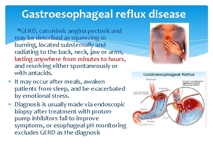 Gastroesophageal reflux disease *GERD, can mimic angina pectoris and may be described as squeezing