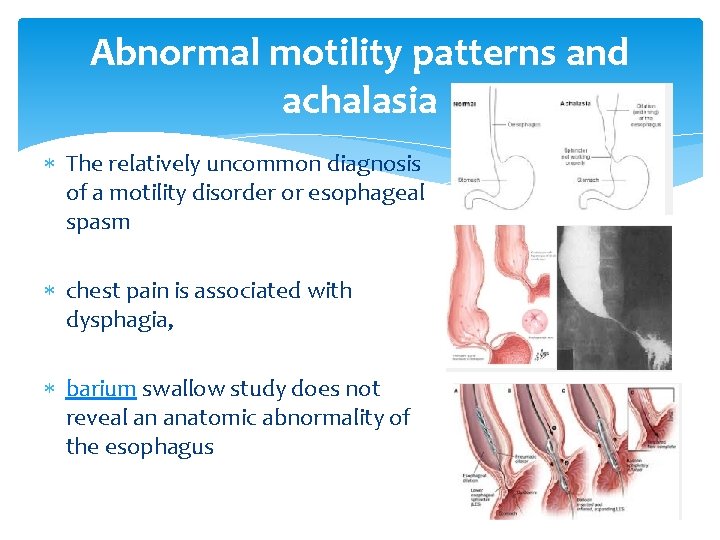 Abnormal motility patterns and achalasia The relatively uncommon diagnosis of a motility disorder or
