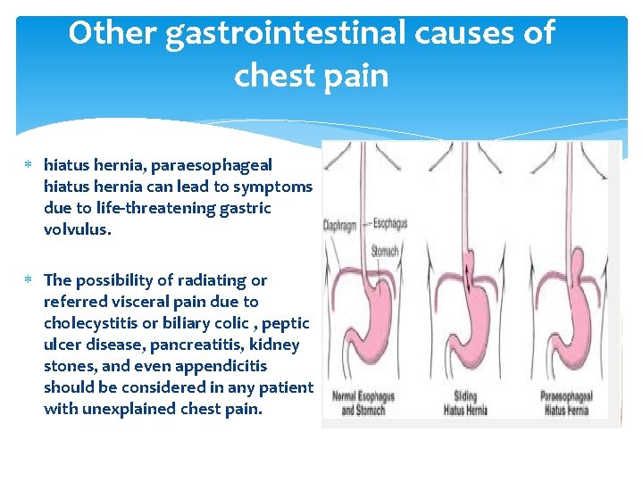 Other gastrointestinal causes of chest pain hiatus hernia, paraesophageal hiatus hernia can lead to