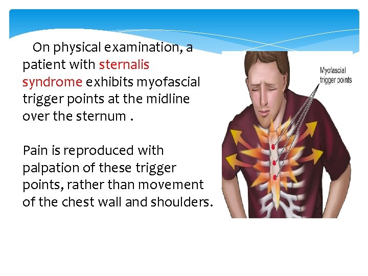  On physical examination, a patient with sternalis syndrome exhibits myofascial trigger points at