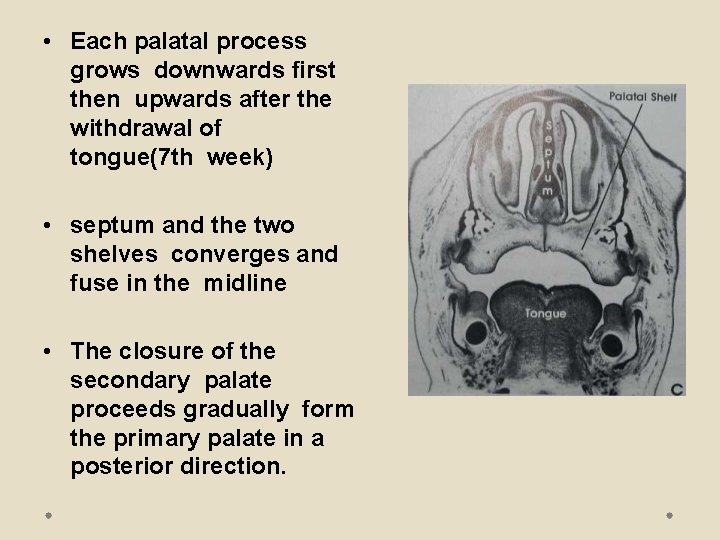  • Each palatal process grows downwards first then upwards after the withdrawal of