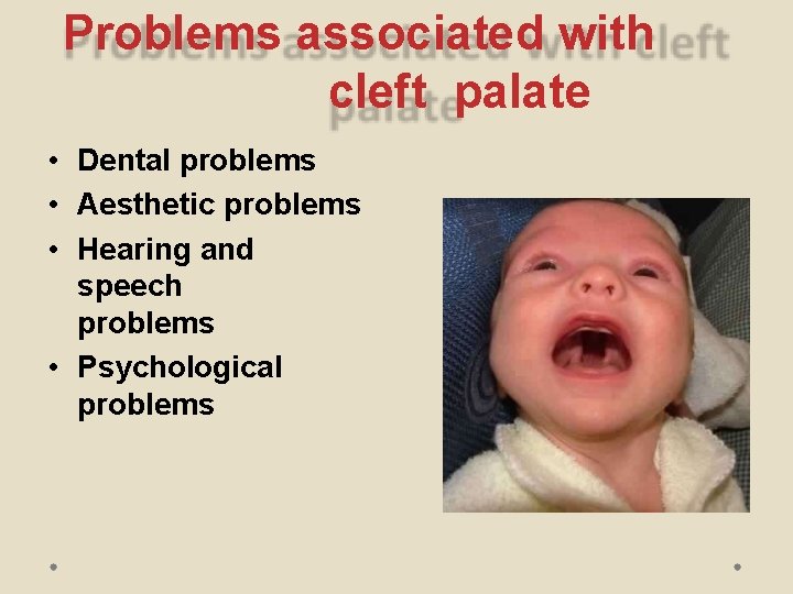 Problems associated with cleft palate • Dental problems • Aesthetic problems • Hearing and