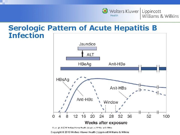 Serologic Pattern of Acute Hepatitis B Infection Copyright © 2010 Wolters Kluwer Health |