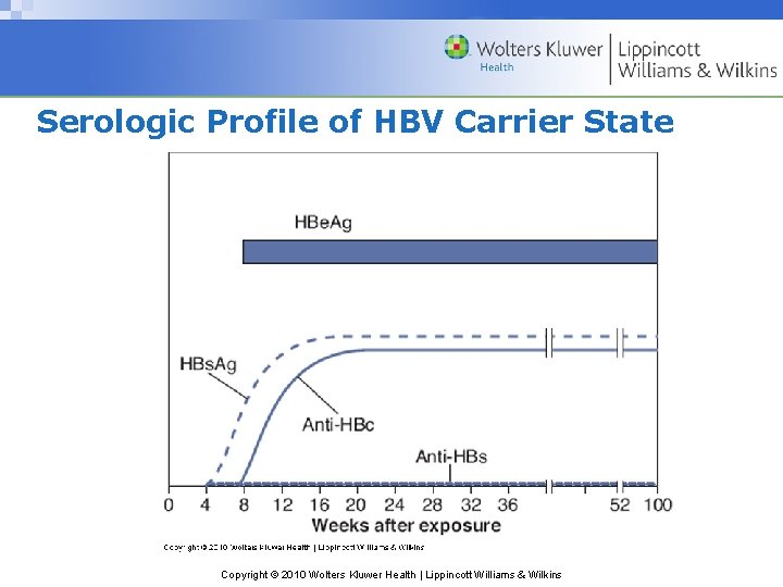 Serologic Profile of HBV Carrier State Copyright © 2010 Wolters Kluwer Health | Lippincott