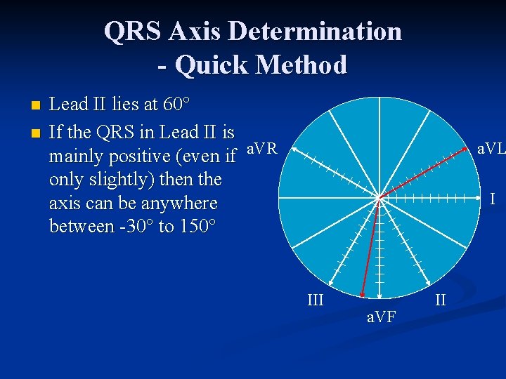 QRS Axis Determination - Quick Method n n Lead II lies at 60° If