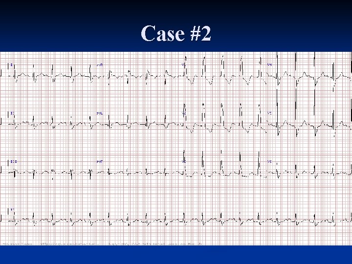 Case #2 