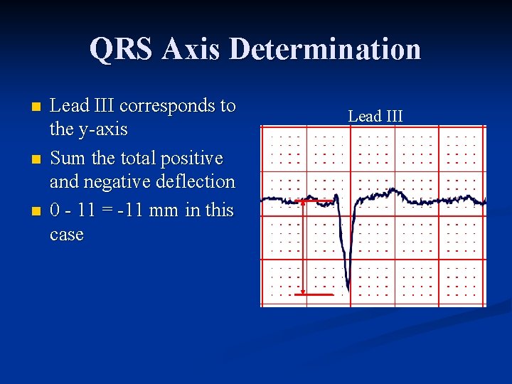 QRS Axis Determination n Lead III corresponds to the y axis Sum the total