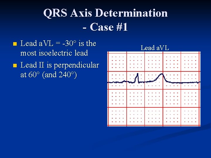 QRS Axis Determination - Case #1 n n Lead a. VL = 30° is