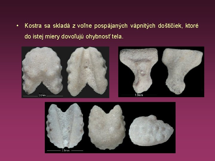  • Kostra sa skladá z voľne pospájaných vápnitých doštičiek, ktoré do istej miery