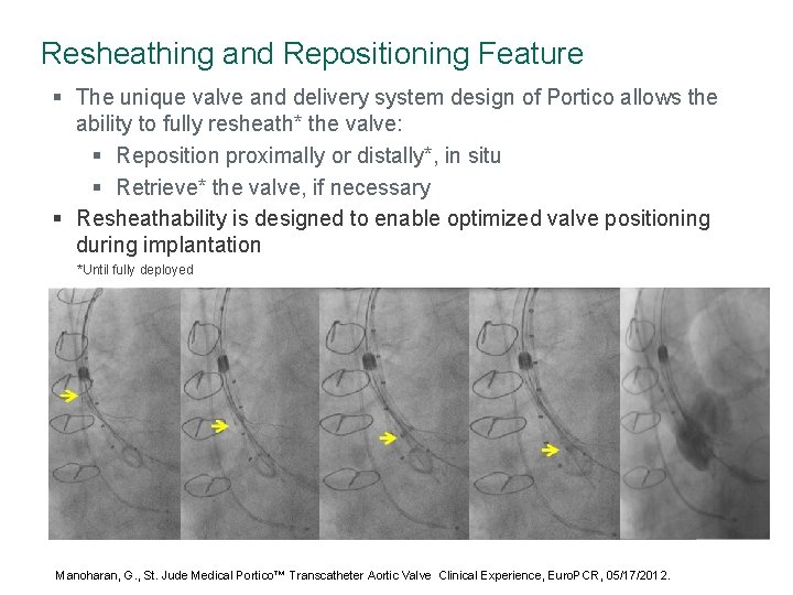 Resheathing and Repositioning Feature § The unique valve and delivery system design of Portico