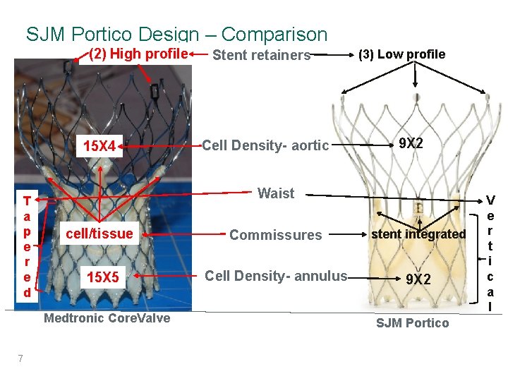 SJM Portico Design – Comparison (2) High profile 15 X 4 T a p