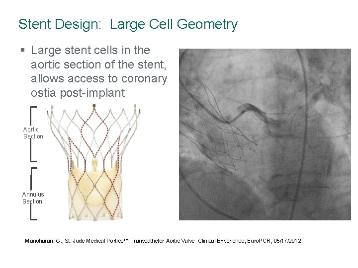 Stent Design: Large Cell Geometry § Large stent cells in the aortic section of
