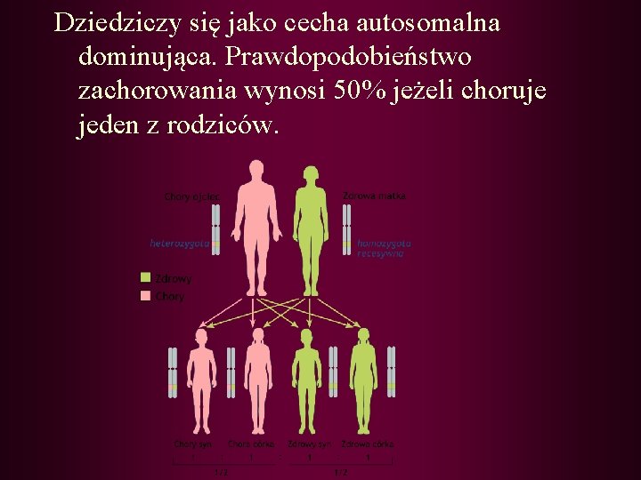 Dziedziczy się jako cecha autosomalna dominująca. Prawdopodobieństwo zachorowania wynosi 50% jeżeli choruje jeden z