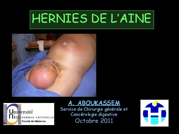 HERNIES DE L’AINE A. ABOUKASSEM Service de Chirurgie générale et Cancérologie digestive Octobre 2011