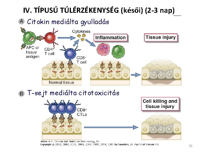 IV. TÍPUSÚ TÚLÉRZÉKENYSÉG (késői) (2 -3 nap) Citokin mediálta gyulladás T-sejt mediálta citotoxicitás 51