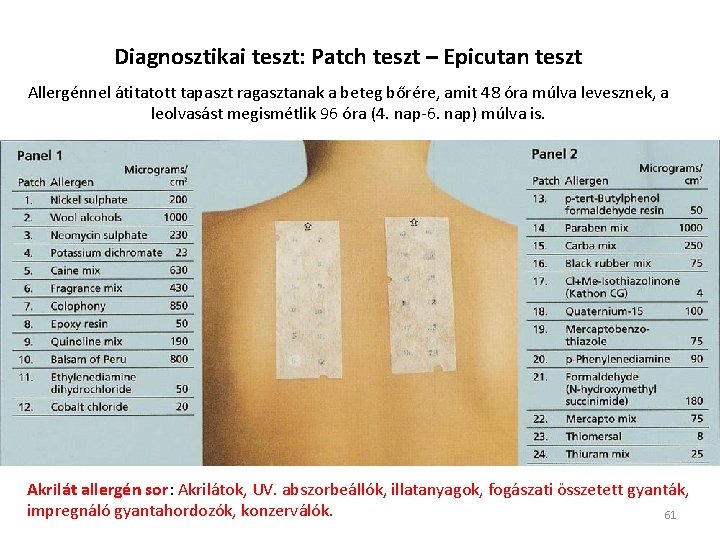 Diagnosztikai teszt: Patch teszt – Epicutan teszt Allergénnel átitatott tapaszt ragasztanak a beteg bőrére,