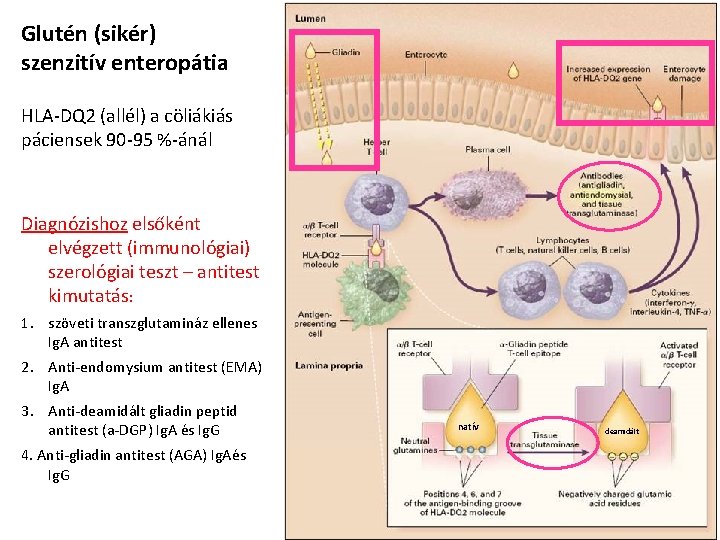 Glutén (sikér) szenzitív enteropátia HLA-DQ 2 (allél) a cöliákiás páciensek 90 -95 %-ánál Diagnózishoz