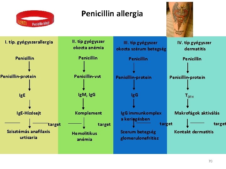 Penicillin allergia I. típ. gyógyszerallergia Penicillin-protein Ig. E-Hízósejt target Szisztémás anafilaxis urticaria II. típ