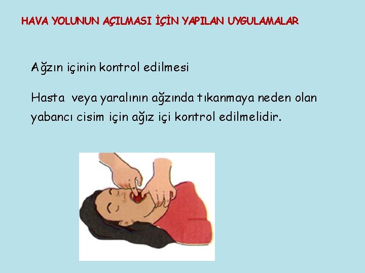 HAVA YOLUNUN AÇILMASI İÇİN YAPILAN UYGULAMALAR Ağzın içinin kontrol edilmesi Hasta veya yaralının ağzında