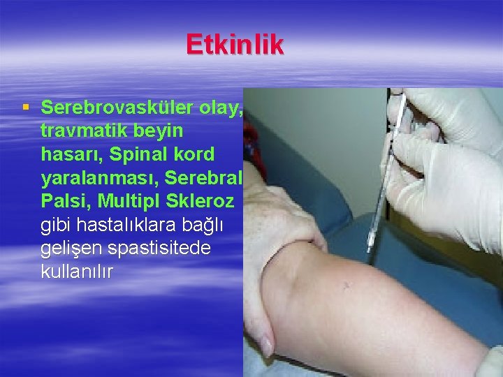 Etkinlik § Serebrovasküler olay, travmatik beyin hasarı, Spinal kord yaralanması, Serebral Palsi, Multipl Skleroz