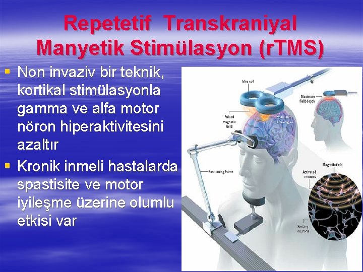 Repetetif Transkraniyal Manyetik Stimülasyon (r. TMS) § Non invaziv bir teknik, kortikal stimülasyonla gamma Repetetif Transkraniyal Manyetik Stimülasyon (r. TMS) § Non invaziv bir teknik, kortikal stimülasyonla gamma