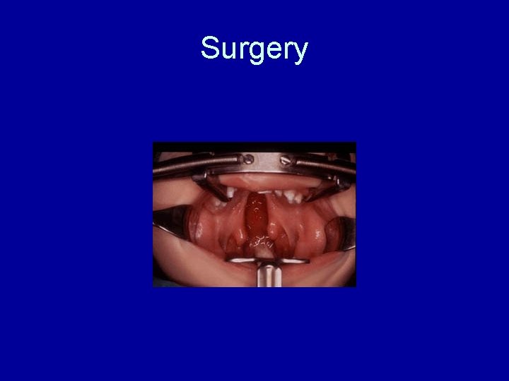 Surgery 
