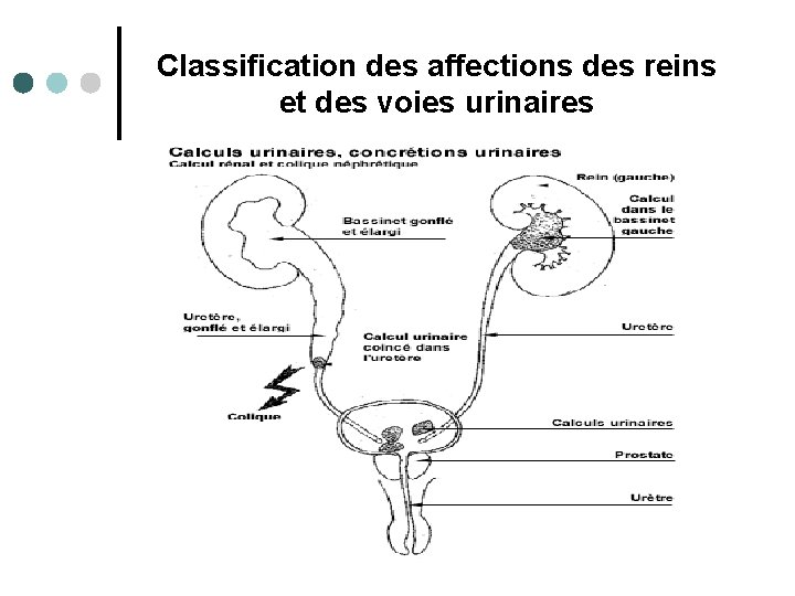 Classification des affections des reins et des voies urinaires 