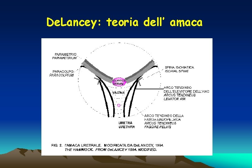 De. Lancey: teoria dell’ amaca 