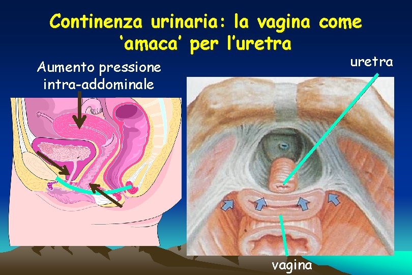 Continenza urinaria: la vagina come ‘amaca’ per l’uretra Aumento pressione intra-addominale vagina 