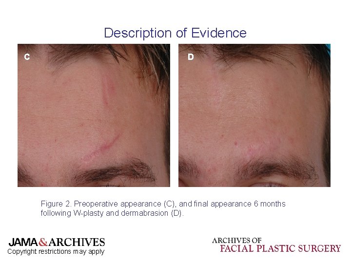 Description of Evidence C D Figure 2. Preoperative appearance (C), and final appearance 6