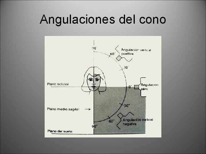 Angulaciones del cono 