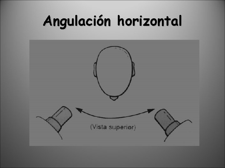 Angulación horizontal 