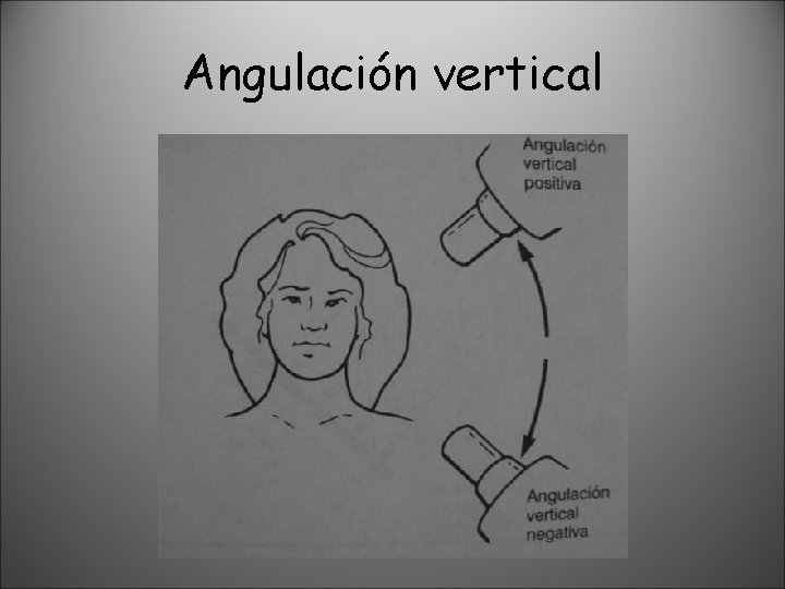 Angulación vertical 