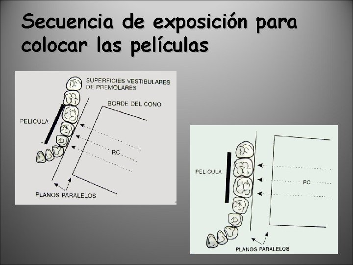 Secuencia de exposición para colocar las películas 