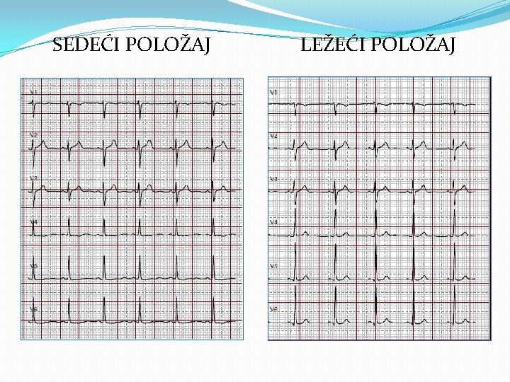 SEDEĆI POLOŽAJ LEŽEĆI POLOŽAJ 