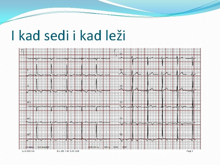 I kad sedi i kad leži 