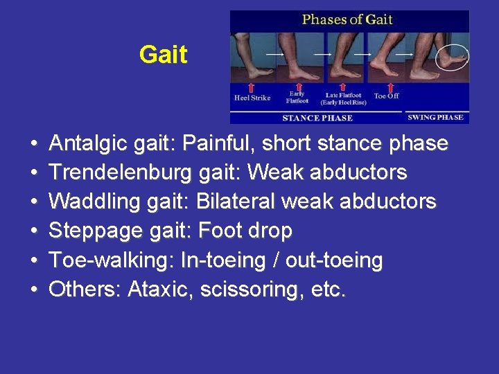 Gait • • • Antalgic gait: Painful, short stance phase Trendelenburg gait: Weak abductors