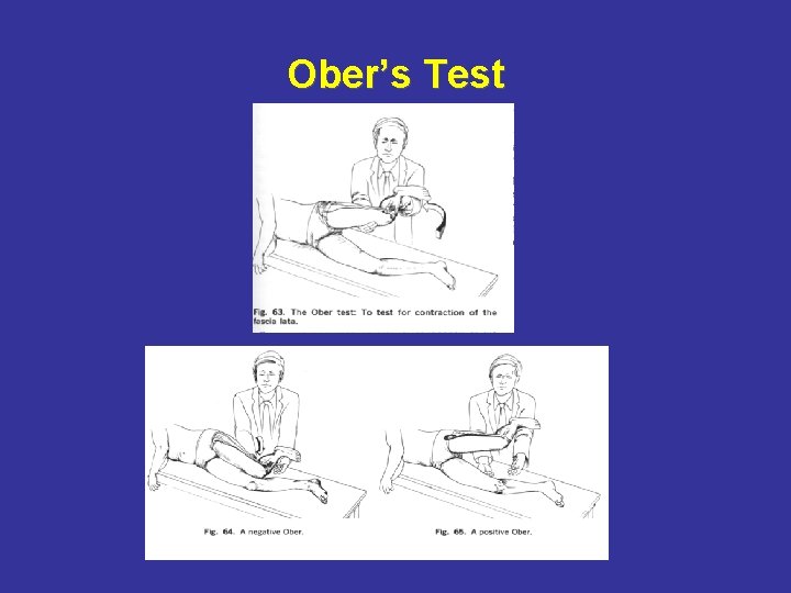Ober’s Test 