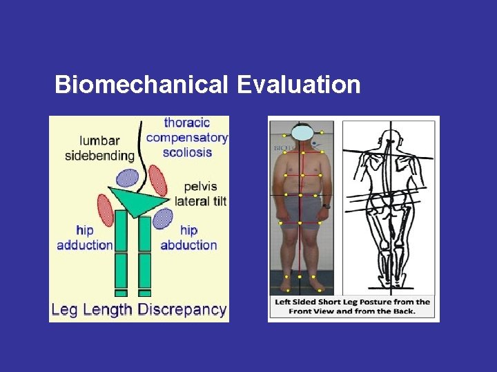 Biomechanical Evaluation 