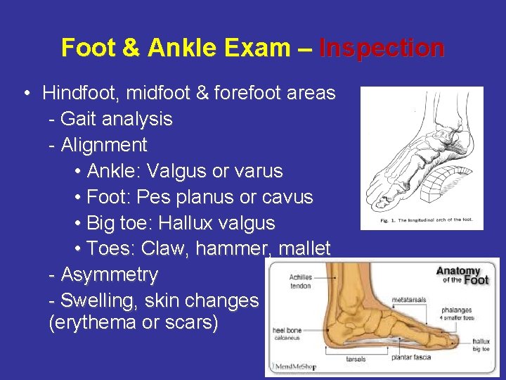 Foot & Ankle Exam – Inspection • Hindfoot, midfoot & forefoot areas - Gait