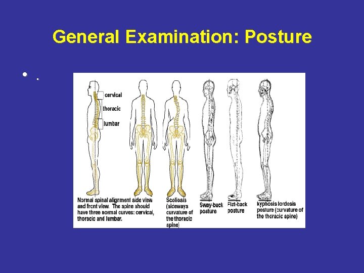 General Examination: Posture • . 